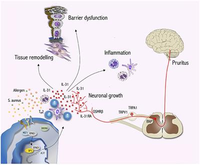 Interleukin-31 Signaling Bridges the Gap Between Immune Cells, the Nervous System and Epithelial Tissues